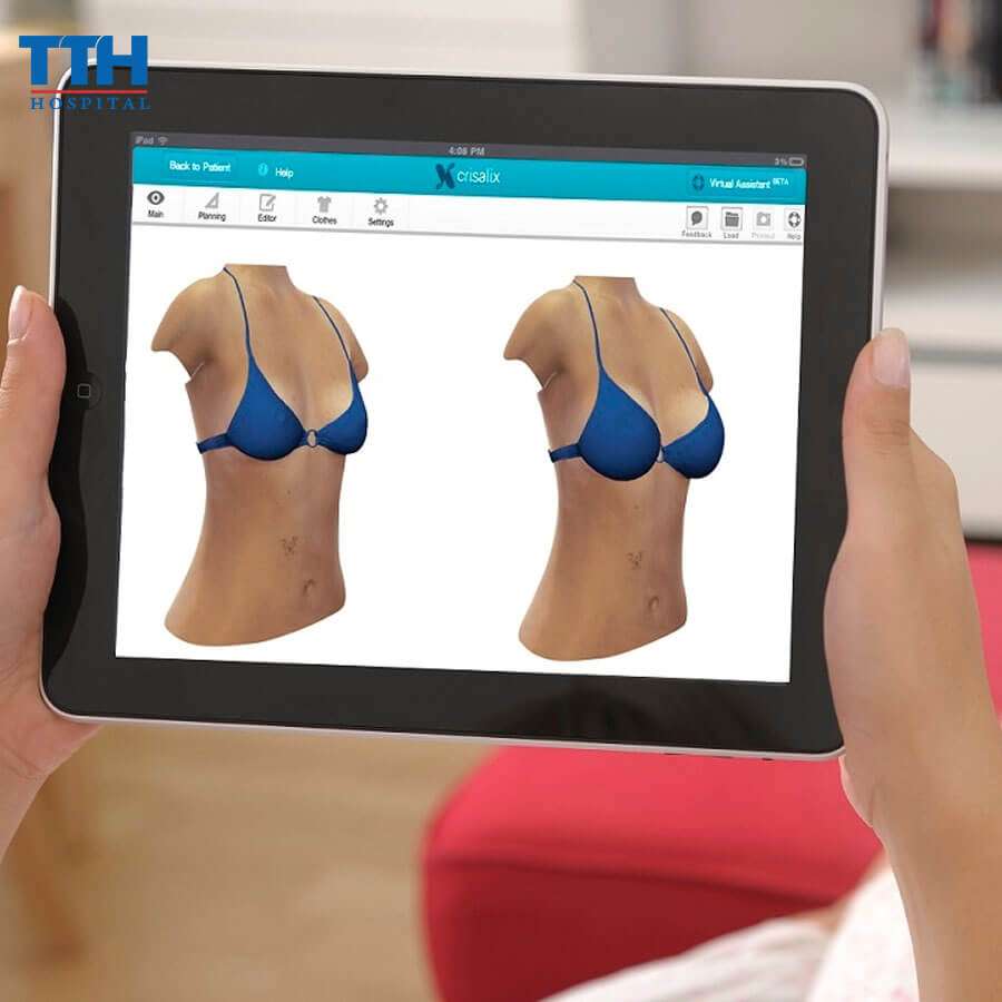 Crisalix - Ứng dụng 3D mô phỏng thực tế ảo cho thẩm mỹ